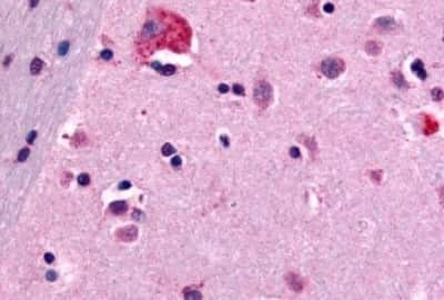 Immunohistochemistry-Paraffin: Cannabinoid R1/CB1/CNR1 Antibody [NBP3-14554] - Immunohistochemistry of formalin-fixed, paraffin-embedded human brain tissue after heat-induced antigen retrieval.